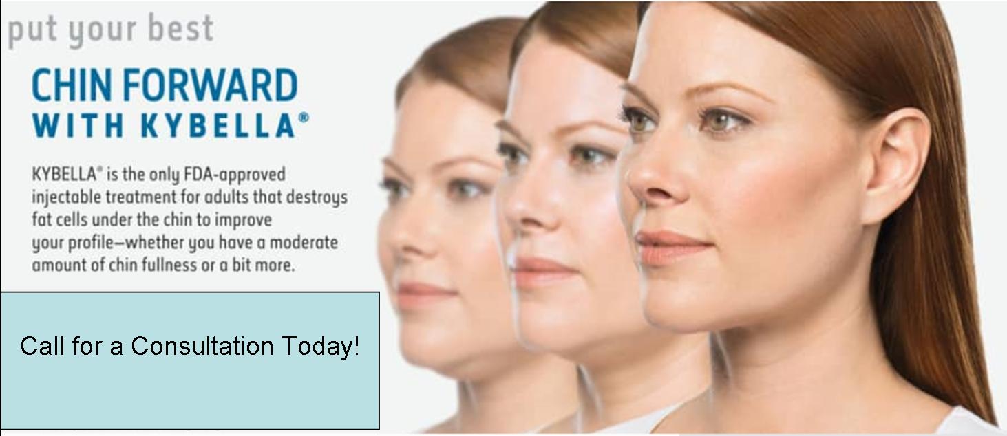 image-616770-kybella.jpg